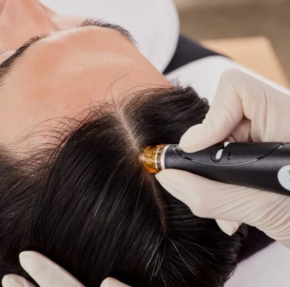 Keravive Scalp Treatment San Gabriel, CA